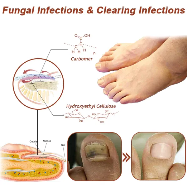 Oveallgo™ NanoPRO Revolutionary High-Efficiency Light Therapy Device For Toenail Diseases