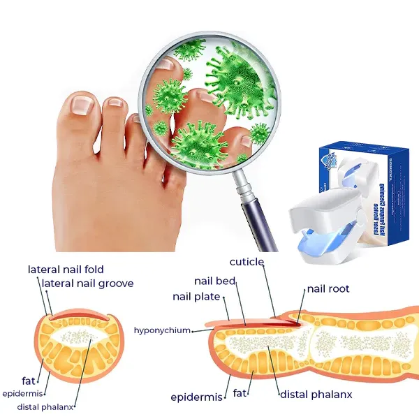 Oveallgo™ NanoPRO Revolutionary High-Efficiency Light Therapy Device For Toenail Diseases